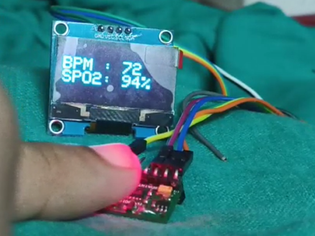 AI Enabled Health Monitor