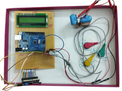 Virtual Reflex Engine - Decoding Reaction Time with Muscle Signals